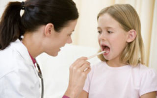 Как лечить у детей инфекционный мононуклеоз?