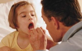 Правильное лечение горла у детей в возрасте от 2 до 5 лет