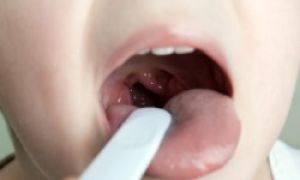 Способы лечения горла у детей до года