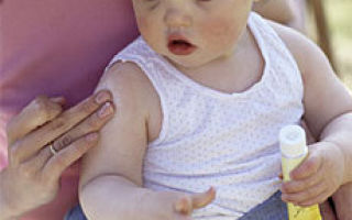 Детский атопический дерматит – как облегчить страдания малыша