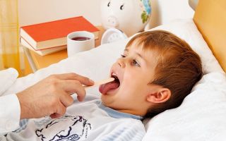 Першение в горле у ребенка — каковы причины и что делать