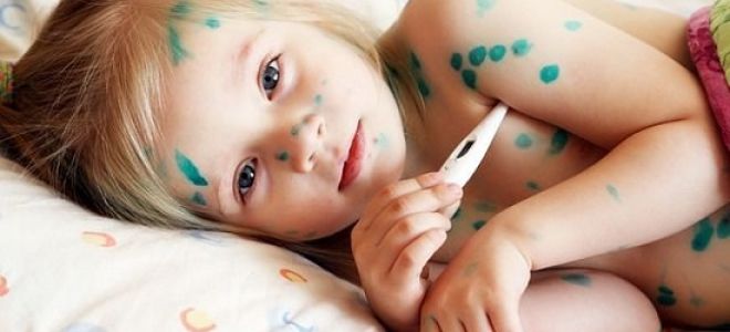 Вашему малышу меньше года и он заболел ветрянкой?