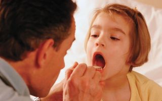 Удаление аденоидов у детей, методики и рекомендации
