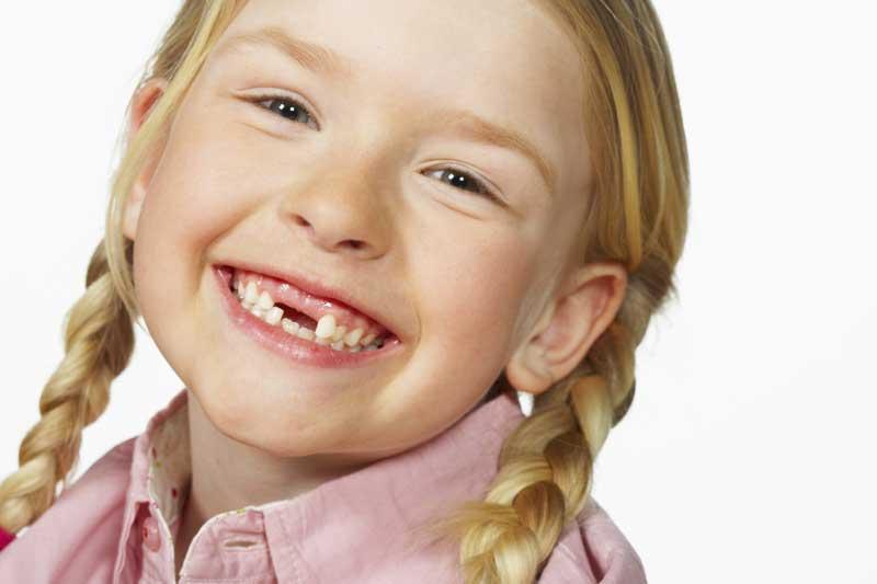 Неправильный рост зубов у детей
